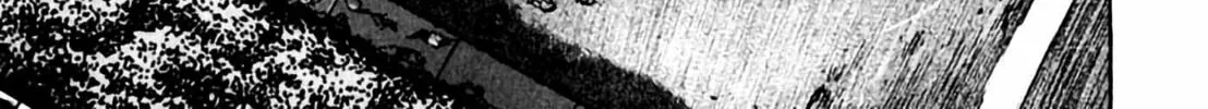 Homunculus Chapter 1 page 162 - 