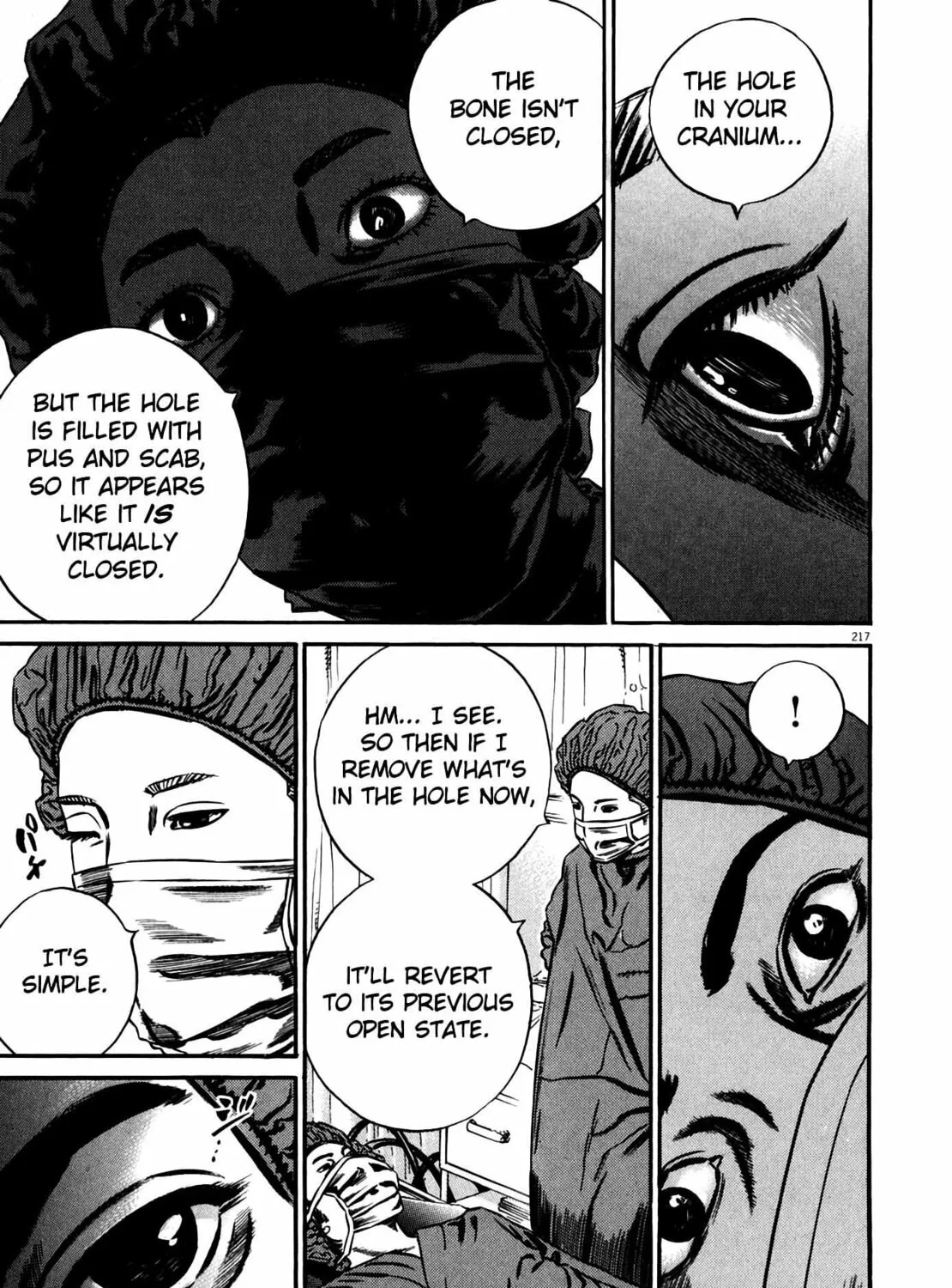 Homunculus Chapter 11 page 419 - 